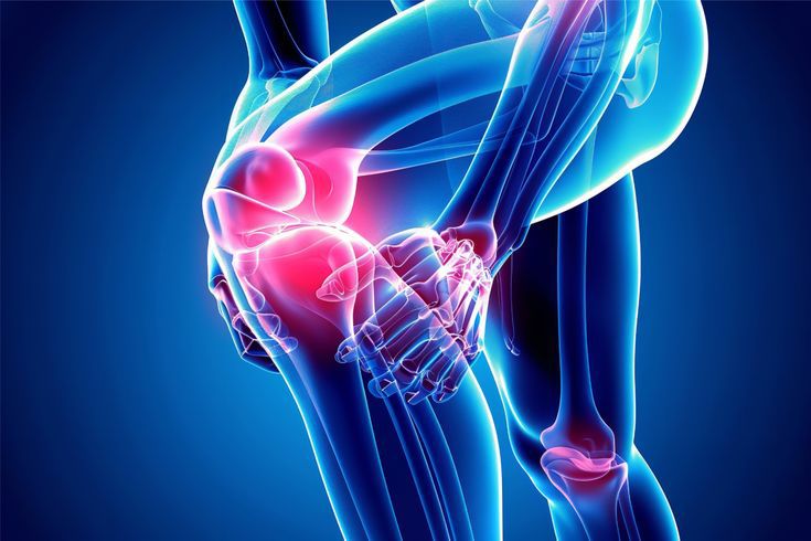 MCL (Medial Collateral Ligament) Knee Injuries: Causes, Symptoms, Diagnosis, Treatment & Rehabilitation